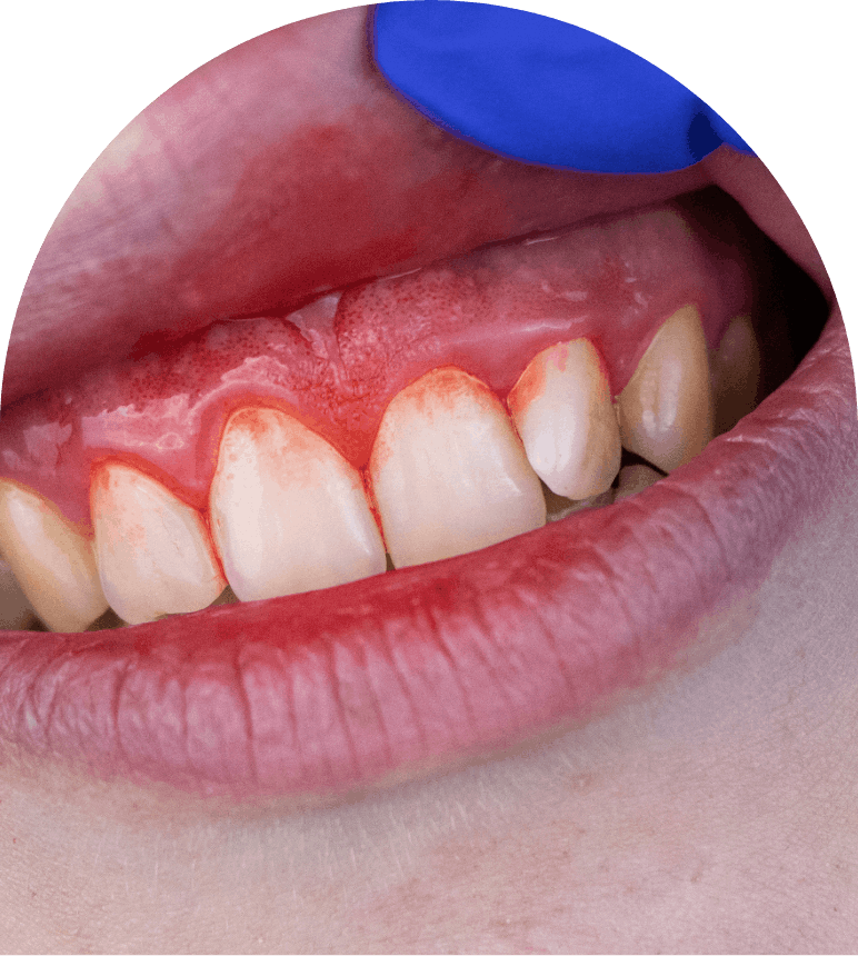 Dene Hollow Dental