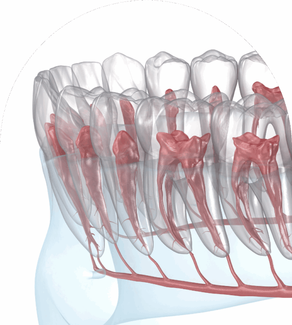 Root Canal Treatment