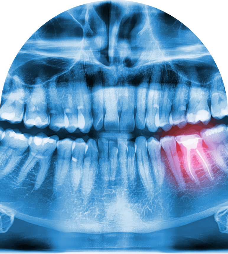 Dene Hollow Dental