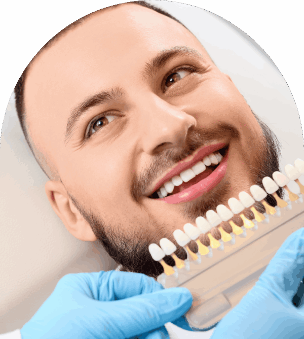 Teeth Whitening