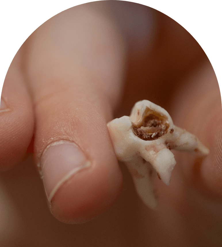Dene Hollow Dental