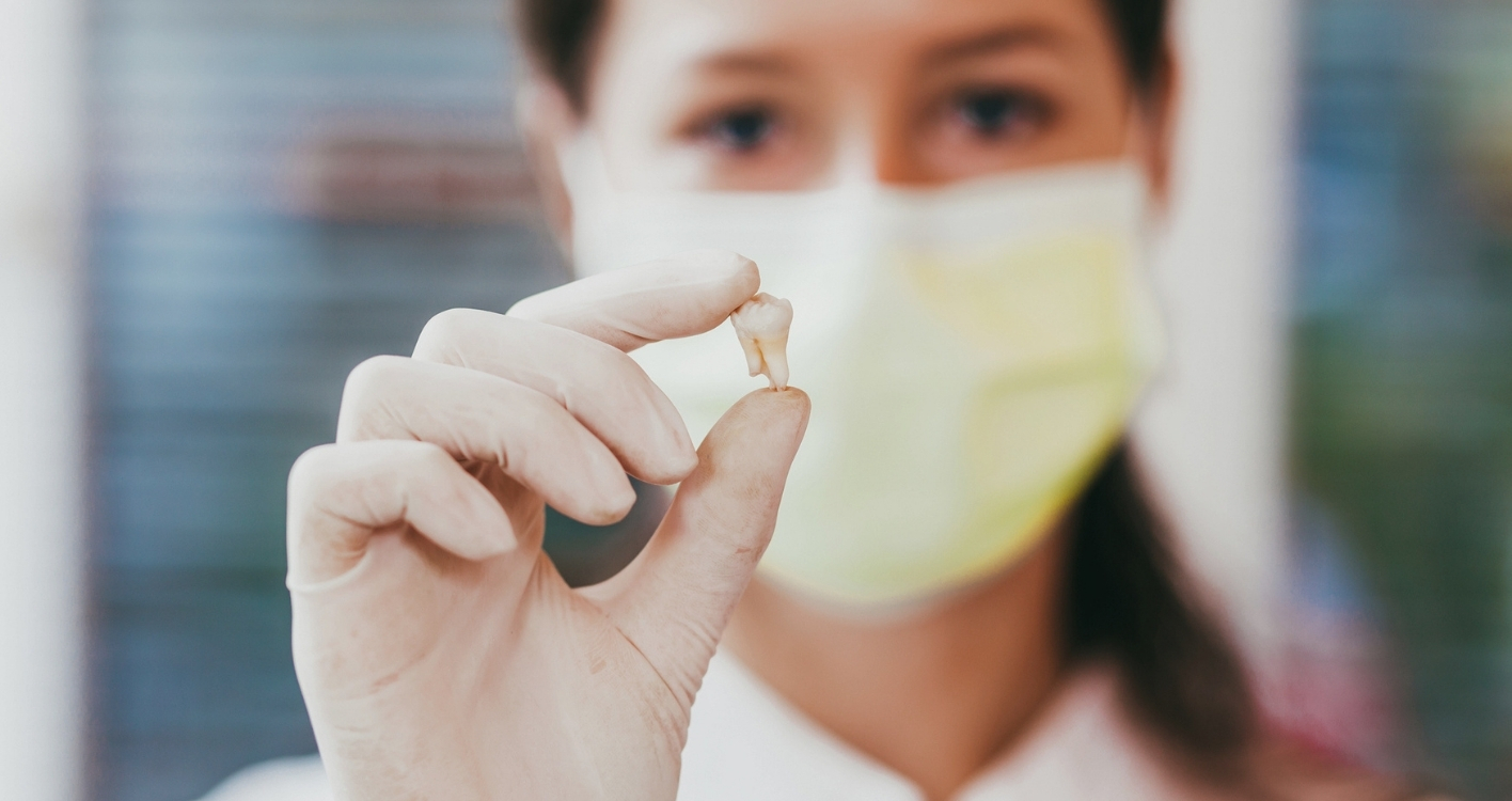 Tooth Extraction